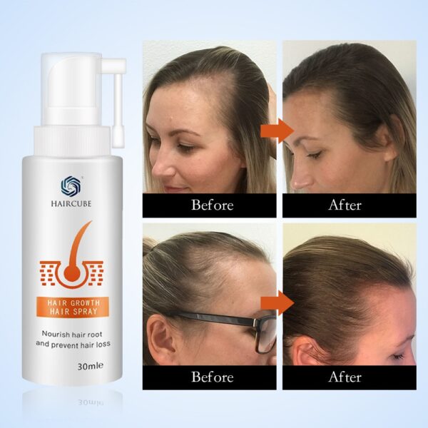 HAIRCUBE Hair Growth Spray Anti Hair Loss Serum for Fast Hair Growth Treatment Oil Hair Tonic Hair Care Hair Loss Products